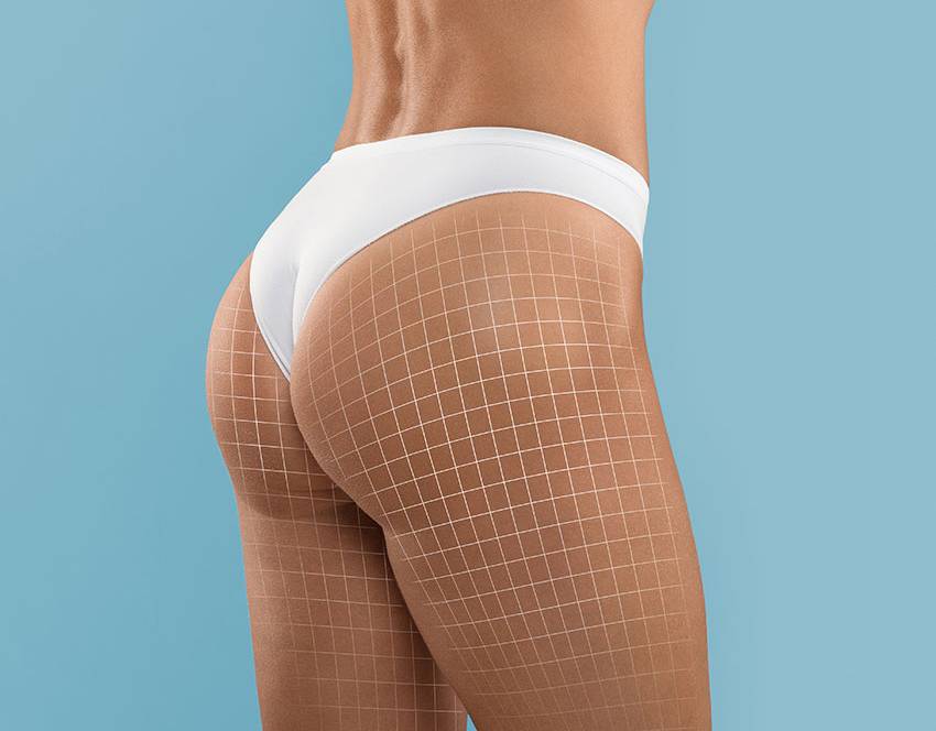 Бразилски лифт на дупето