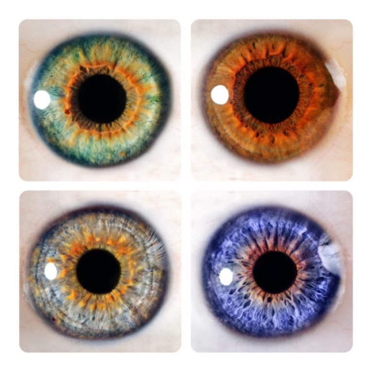 goz-rengini-degistirme-ameliyat